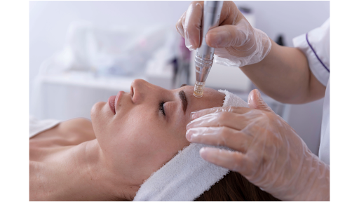 SkinPen microneedling